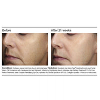 PCA Skin Vitamin b3 Brightening Serum - Totality Skincare