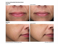 Revision Skincare Revox Line Relaxer - Totality Skincare