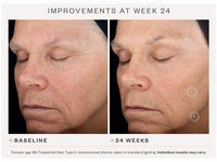 SkinMedica TNS® Advanced+ Serum - Totality Skincare