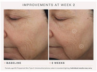 SkinMedica TNS® Advanced+ Serum - Totality Skincare