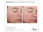 Skinmedica Retinol Complex - Totality Skincare