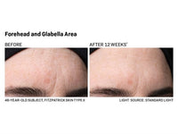 Revision Skincare Revox Line Relaxer - Totality Skincare