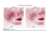 Sente Dermal Repair Ultra-Nourish 1.7 oz - Totality Skincare