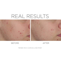 Cosmedix SHINELESS Oil-Free Moisturizer - Totality Skincare
