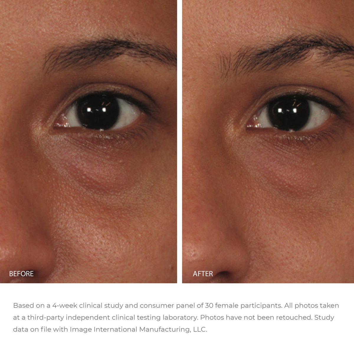 IMAGE Skincare ORMEDIC Balancing Eye Lift Gel - Totality Skincare