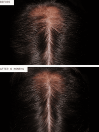 Nutrafol Men - Totality Skincare