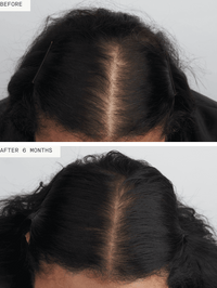Nutrafol Women’s Balance - Totality Skincare