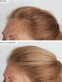 Nutrafol Women’s Balance - Totality Skincare