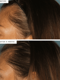 Nutrafol Women - no barcodes - Totality Skincare