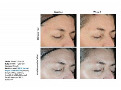 Sente Dermal Repair Ultra-Nourish 1.7 oz - Totality Skincare
