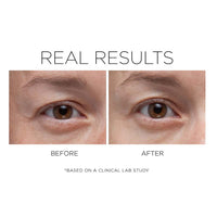 Cosmedix OPTI CRYSTAL Liquid Crystal Eye Serum - Totality Skincare