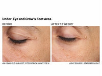Revision Skincare Revox Line Relaxer - Totality Skincare
