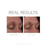 Cosmedix SERUM 16 Vitamin A Retinol Serum - Totality Skincare