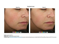 Sente Dermal Repair Ultra-Nourish 1.7 oz - Totality Skincare