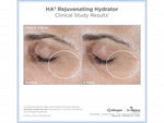 SkinMedica HA⁵® Rejuvenating Hydrator - Totality Skincare